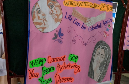World Vitiligo Day